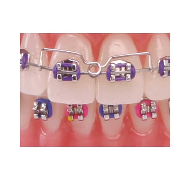 Torquing Spring — American Orthodontics