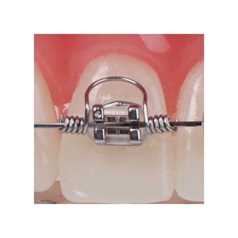 Warren Torquing Spring — American Orthodontics