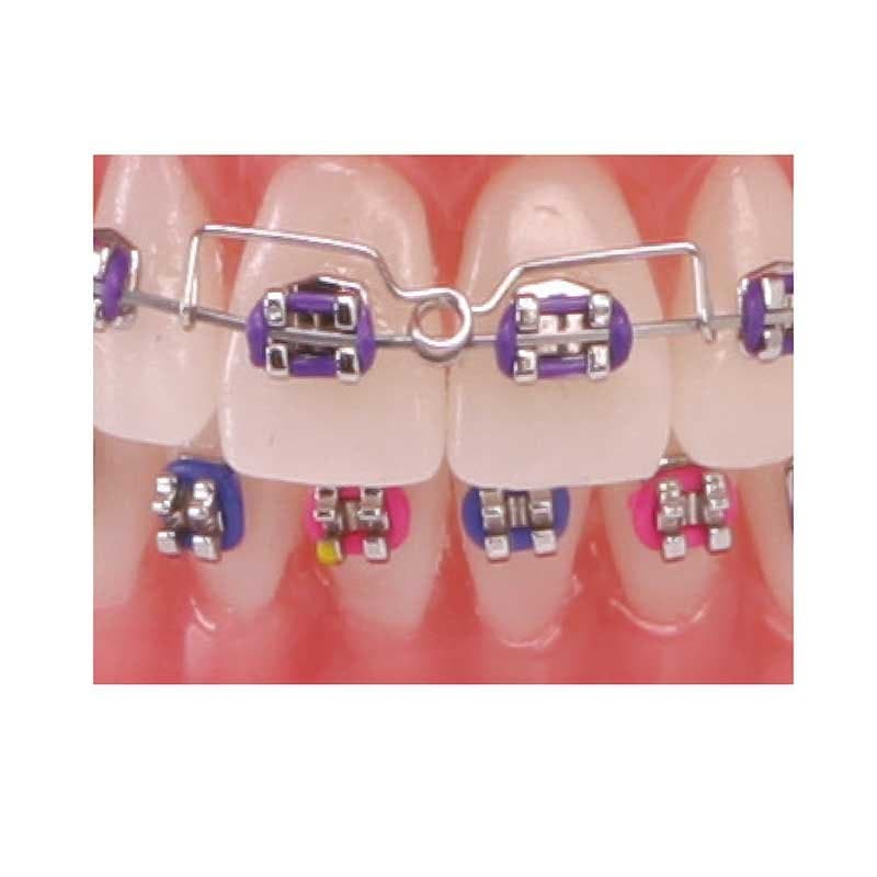 Torquing Spring — American Orthodontics