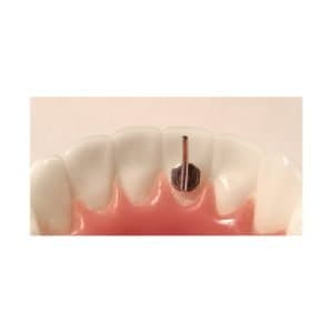 Pique langue — American Orthodontics