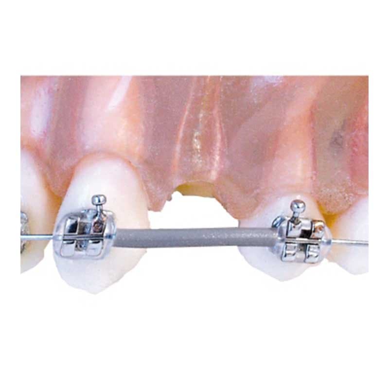 Gaine de protection — American Orthodontics