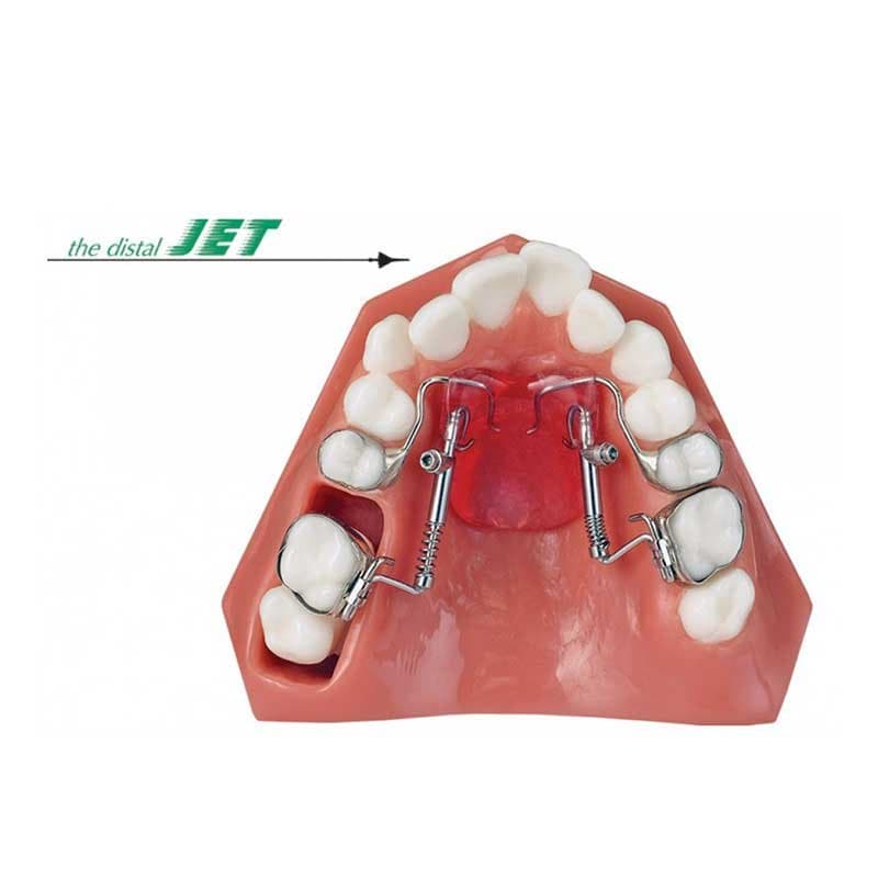 DISTAL JET — American Orthodontics